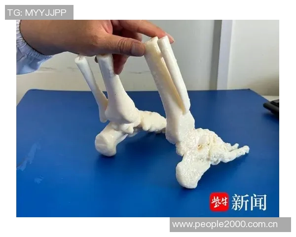 米体报道S希门尼斯考虑右脚踝手术决定将在未来几天做出